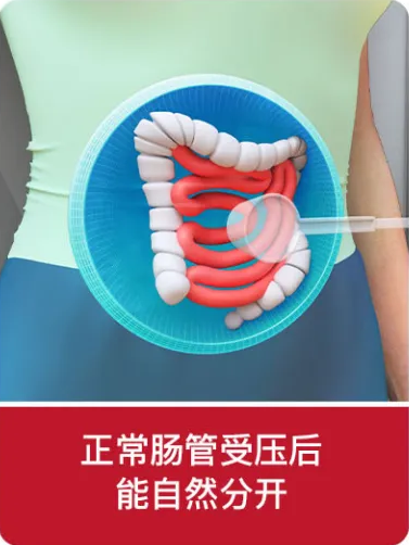 1701670534621028.png 640.png